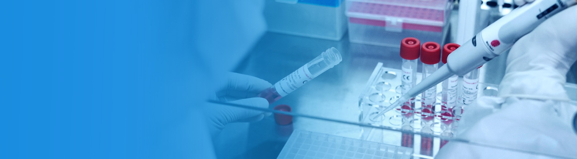 Κιτ ταχείας δοκιμής